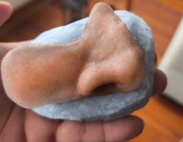 Prótesis de nariz de silicona